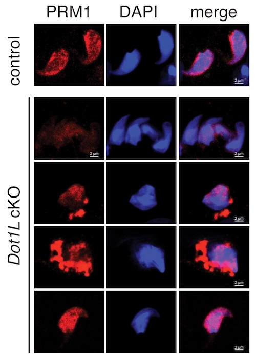 PRM1 in Dot1l cKO